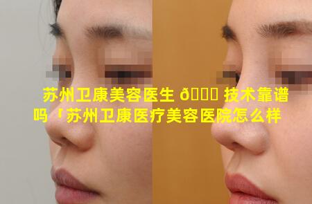 苏州卫康美容医生 🐞 技术靠谱吗「苏州卫康医疗美容医院怎么样」